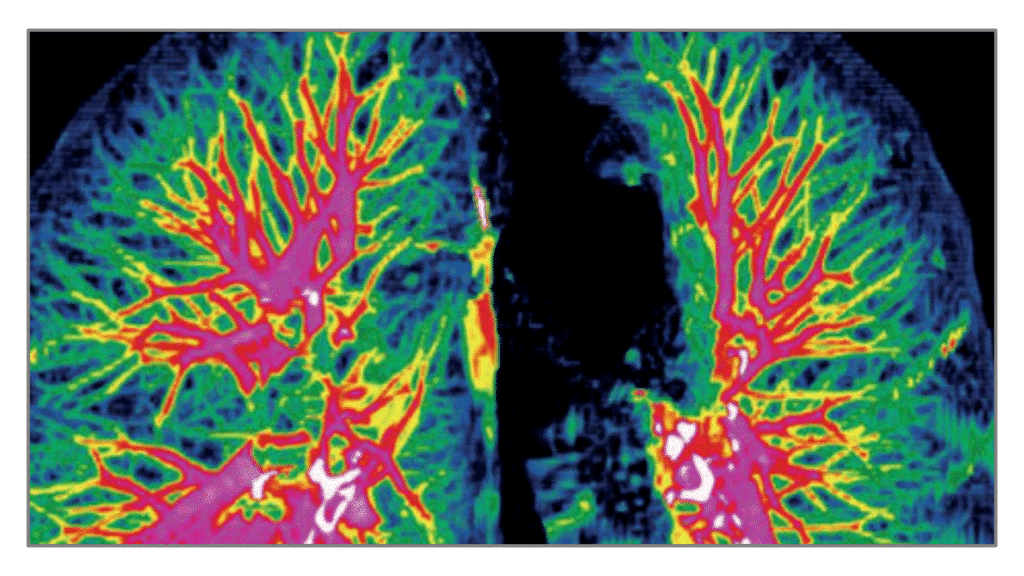 Miniature du DU Carcinologie thoracique intégrée - CICT de Gustave Roussy et l'université Paris-Saclay